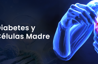 Diabetes y células madre